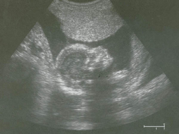 Scanned Photo-2-7_edited